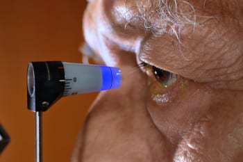 Elderly man being checked for Glaucoma